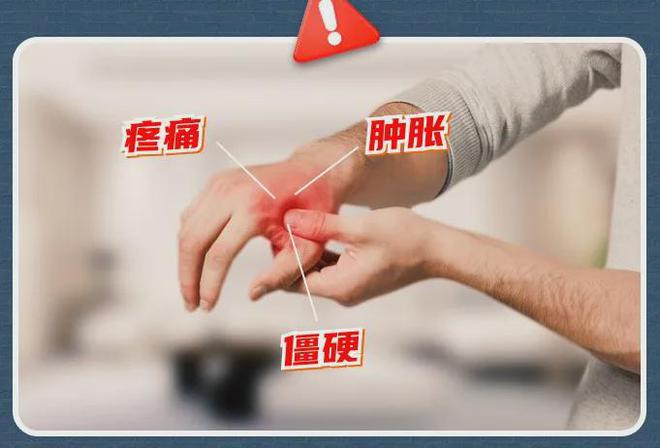 手酸、手麻、腱鞘问题推荐用它！千亿国际游戏小米生态杀疯了！(图4)