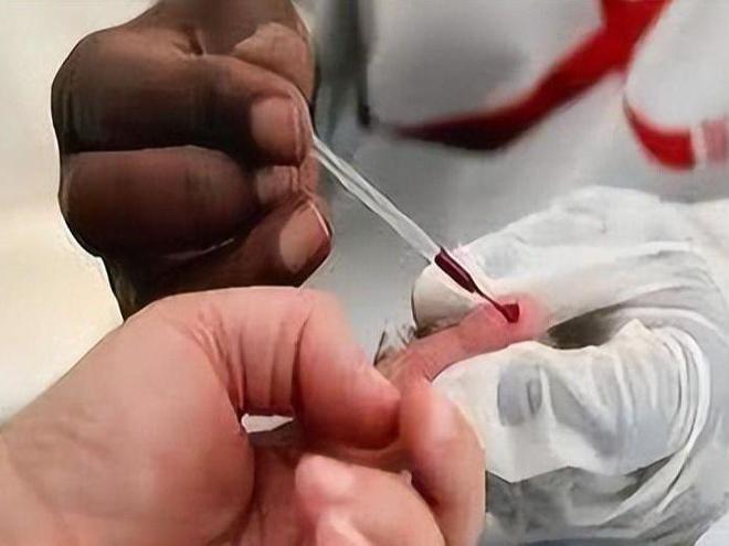 染艾滋央视提示：这两类人群特别注意千亿国际游戏新增上百万近四千万人感(图8)